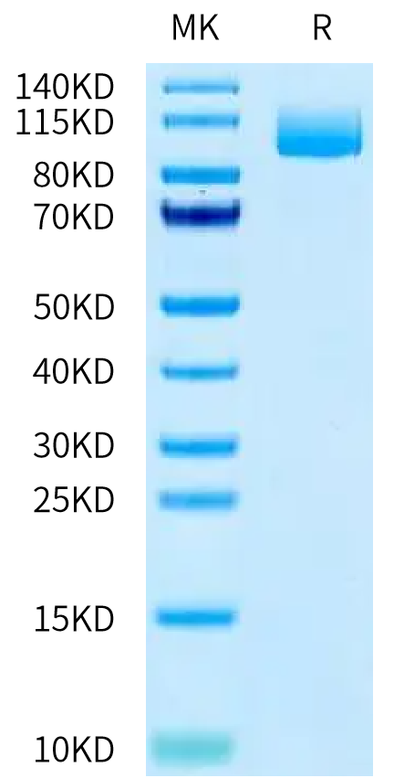 Human LRRC15 on Tris-Bis PAGE under reduced condition. The purity is greater than 95%.Recombinant Human LRRC15/LIB Protein, Active