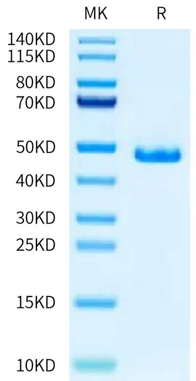 Human G-CSF on Tris-Bis PAGE under reduced condition. The purity is greater than 95%.Recombinant Human G-CSF Protein, Active