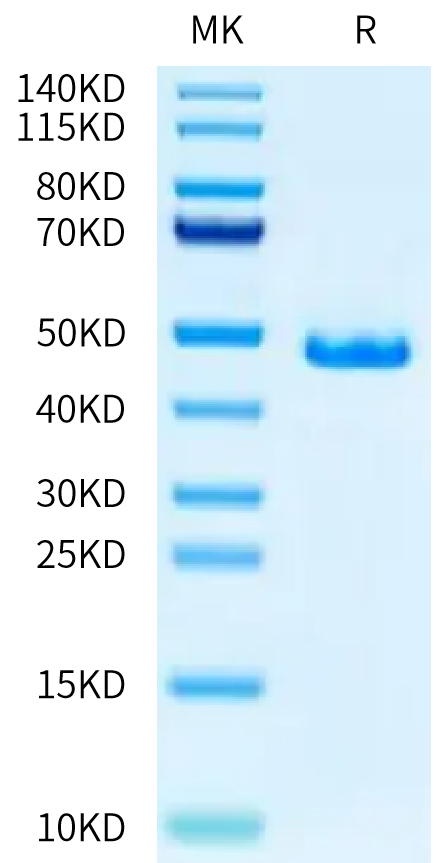 Human G-CSF on Tris-Bis PAGE under reduced condition. The purity is greater than 95%.Recombinant Human G-CSF Protein, Active