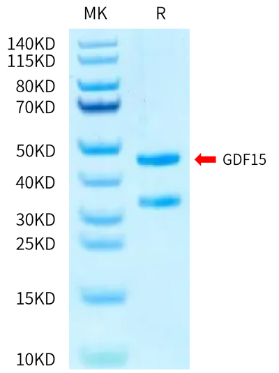 Human GDF15 (H202D) on Bis-Tris PAGE under reduced condition. The purity is greater than 95%.Recombinant Human GDF15 (H202D) Protein, Active