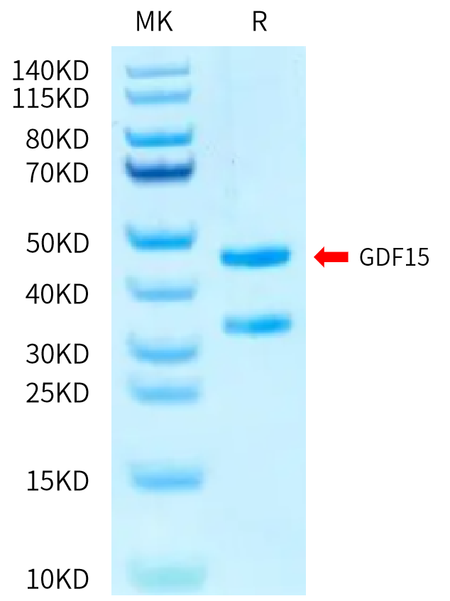 Human GDF15 (H202D) on Bis-Tris PAGE under reduced condition. The purity is greater than 95%.Recombinant Human GDF15 (H202D) Protein, Active