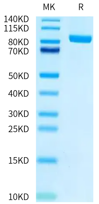 Biotinylated Human FAP on Tris-Bis PAGE under reduced conditions. The purity is greater than 95%.Biotinylated Human FAP Protein, Active