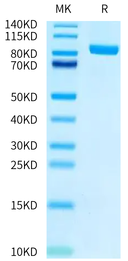 Biotinylated Human FAP on Tris-Bis PAGE under reduced conditions. The purity is greater than 95%.Biotinylated Human FAP Protein, Active