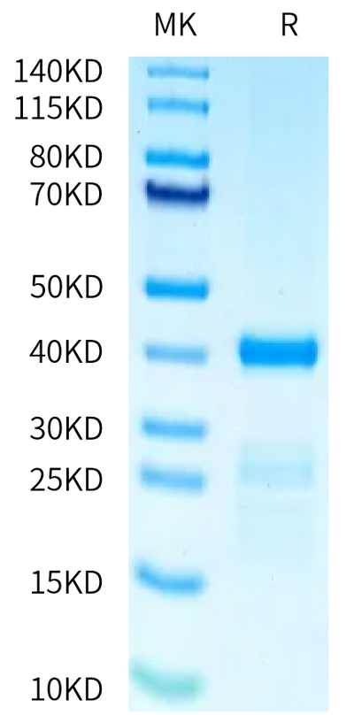 Human PRAK on Tris-Bis PAGE under reduced condition. The purity is greater than 90%.Recombinant Human PRAK Protein