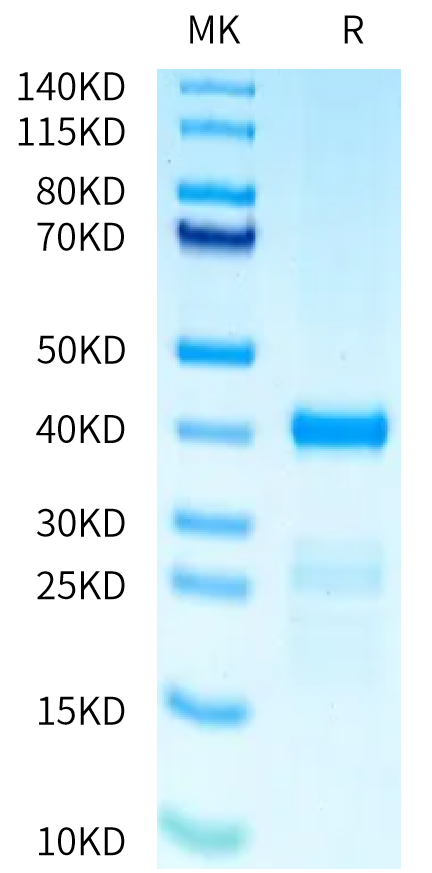 Human PRAK on Tris-Bis PAGE under reduced condition. The purity is greater than 90%.Recombinant Human PRAK Protein