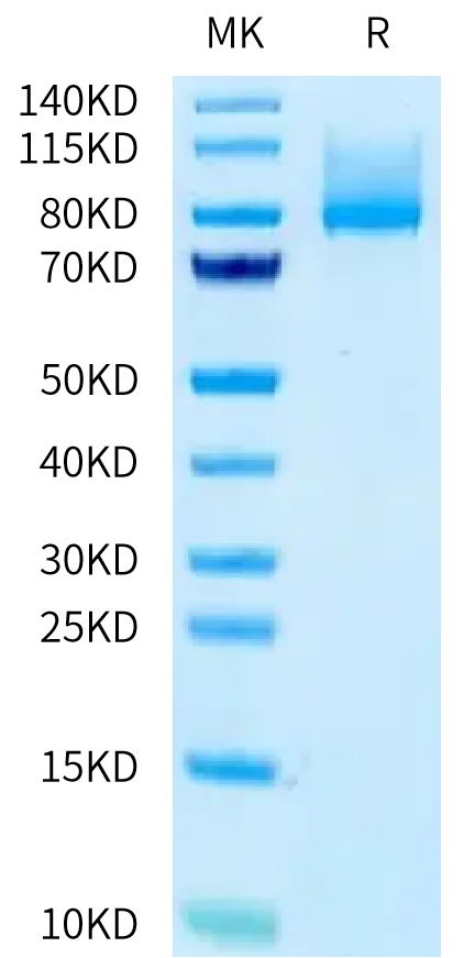 Human CDH6 on Tris-Bis PAGE under reduced condition. The purity is greater than 90%.Recombinant Human CDH6/Cadherin-6 Protein, Active