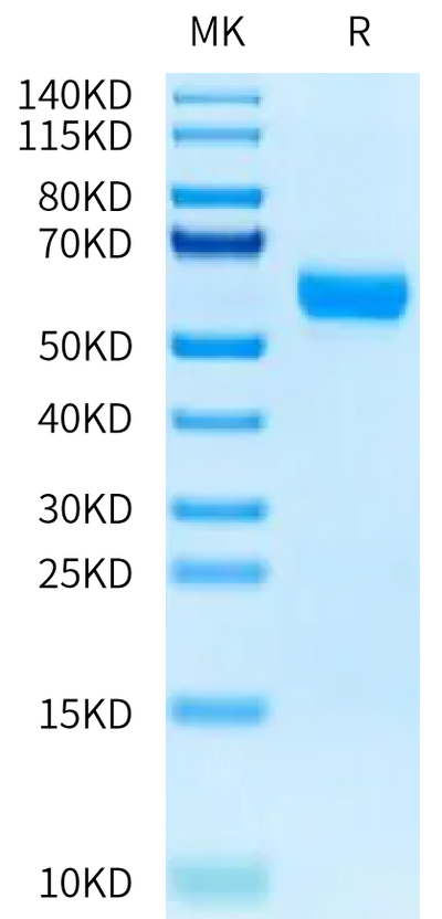 Human Osteomodulin on Tris-Bis PAGE under reduced condition. The purity is greater than 95%.Recombinant Human Osteomodulin Protein