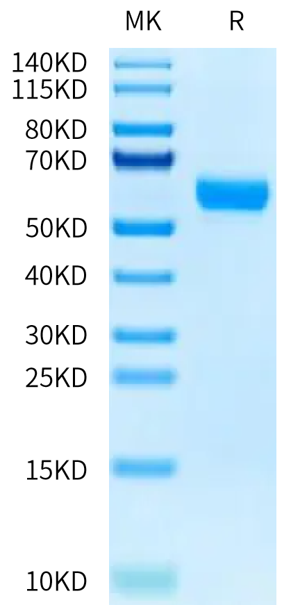 Human Osteomodulin on Tris-Bis PAGE under reduced condition. The purity is greater than 95%.Recombinant Human Osteomodulin Protein