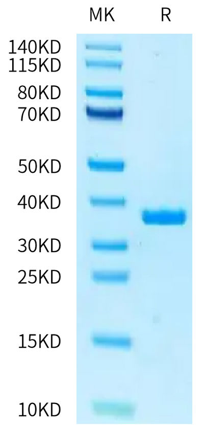 Human ficolin 1 on Tris-Bis PAGE under reduced condition. The purity is greater than 95%.Recombinant Human ficolin 1/FCN1 Protein
