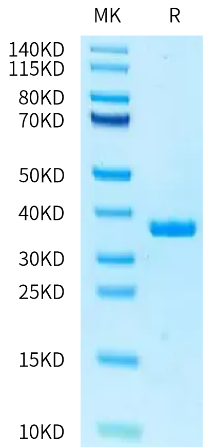 Human ficolin 1 on Tris-Bis PAGE under reduced condition. The purity is greater than 95%.Recombinant Human ficolin 1/FCN1 Protein
