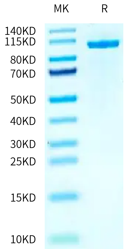 Mouse AARS1 on Tris-Bis PAGE under reduced condition. The purity is greater than 95%.Recombinant Mouse AARS1 Protein