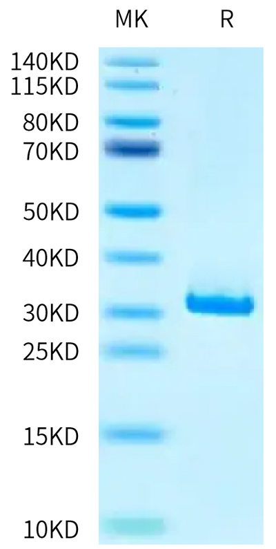 Mouse CA2 on Tris-Bis PAGE under reduced condition. The purity is greater than 95%.Recombinant Mouse CA2/Carbonic anhydrase II Protein
