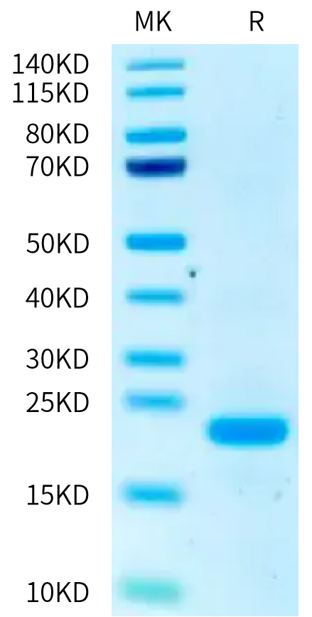 Human CARHSP1 on Tris-Bis PAGE under reduced condition. The purity is greater than 95%.Recombinant Human CARHSP1 Protein