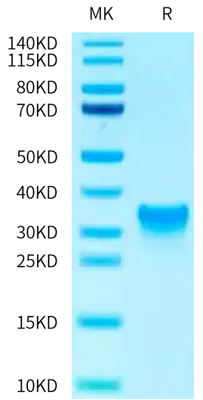 Human Oncostatin M on Tris-Bis PAGE under reduced condition. The purity is greater than 95%.Recombinant Human Oncostatin M/OSM Protein, Active