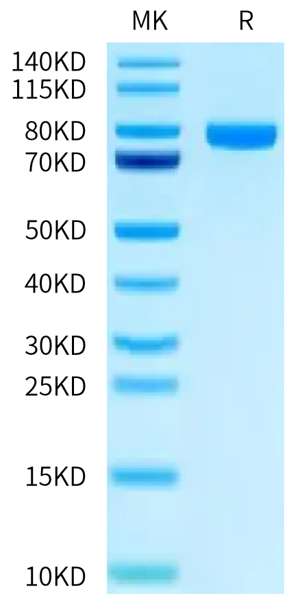 Human IL-1 R9 on Tris-Bis PAGE under reduced condition. The purity is greater than 95%.Recombinant Human IL-1 R9 Protein