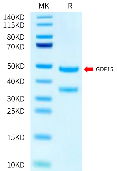 Biotinylated Human GDF15 (H202D) on Tris-Bis PAGE under reduced condition. The purity is greater than 95%.Biotinylated Human GDF15 (H202D) Protein (Primary Amine Labeling), Active
