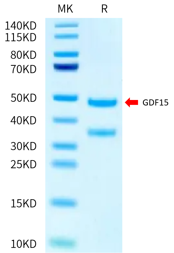 Biotinylated Human GDF15 (H202D) on Tris-Bis PAGE under reduced condition. The purity is greater than 95%.Biotinylated Human GDF15 (H202D) Protein (Primary Amine Labeling), Active