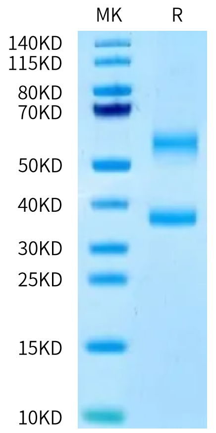 Human BTN2A1&BTN3A1 complex on Tris-Bis PAGE under reduced condition. The purity is greater than 95%.Recombinant Human BTN2A1&BTN3A1 complex Protein, Active