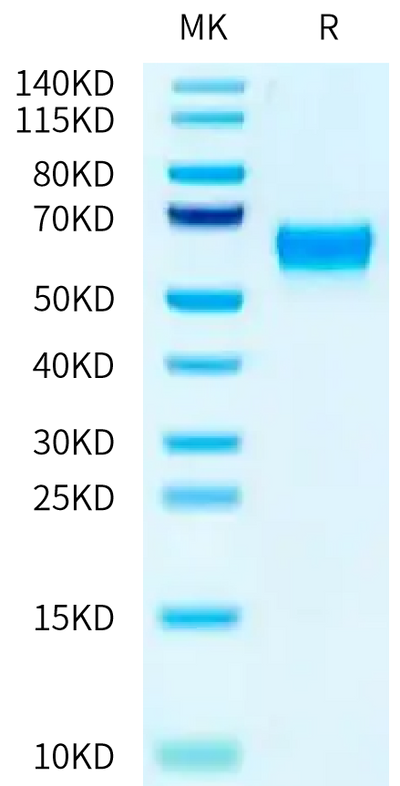 Biotinylated Mouse FcRn on Tris-Bis PAGE under reduced condition. The purity is greater than 95%.Biotinylated Mouse FcRn Protein, Active