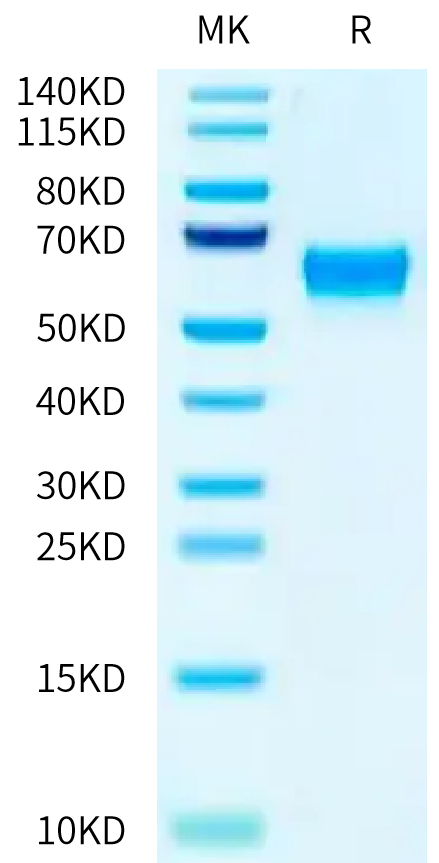 Biotinylated Mouse FcRn on Tris-Bis PAGE under reduced condition. The purity is greater than 95%.Biotinylated Mouse FcRn Protein, Active