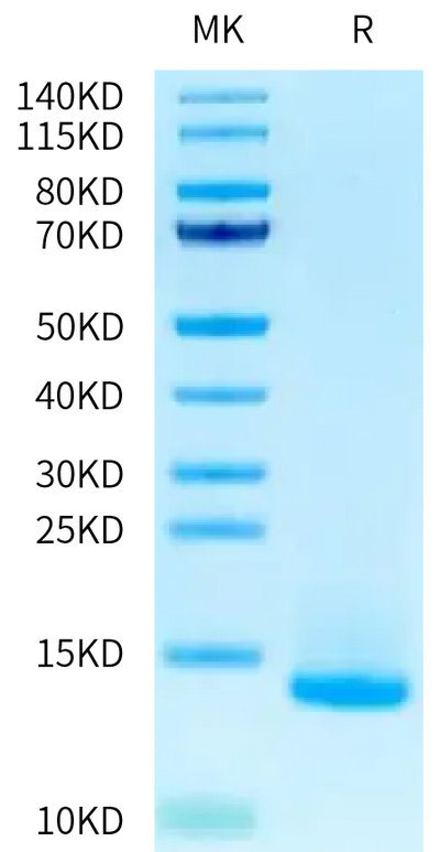 Human LY6G6D on Tris-Bis PAGE under reduced condition. The purity is greater than 95%.Recombinant Human LY6G6D Protein, Active