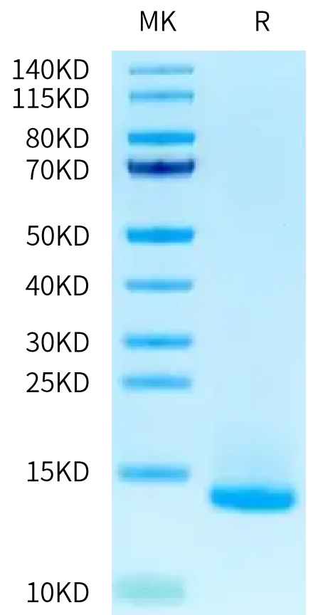 Human LY6G6D on Tris-Bis PAGE under reduced condition. The purity is greater than 95%.Recombinant Human LY6G6D Protein, Active