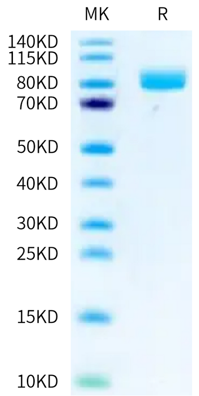 Rhesus macaque IL-18 R1 on Tris-Bis PAGE under reduced condition. The purity is greater than 95%.Recombinant Rhesus macaque IL-18 R1/CD218a Protein, Active