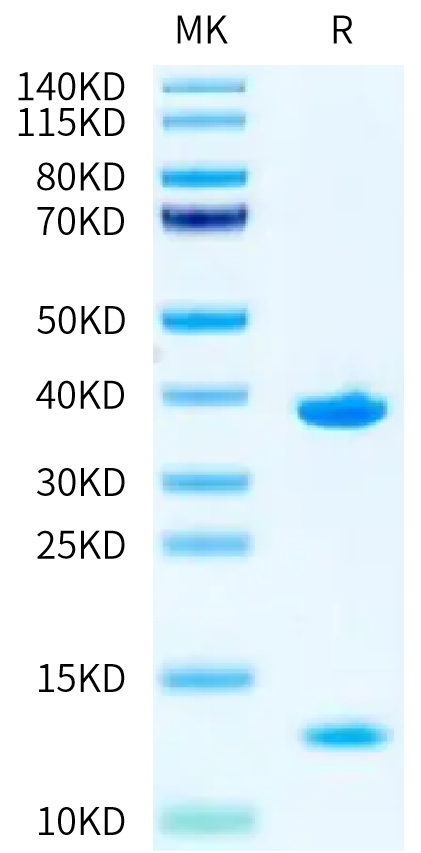 Biotinylated Human HLA-A*11:01&B2M&KRAS G12V (VVVGAVGVGK) Monomer on Tris-Bis PAGE under reduced condition. The purity is greater than 95%.Biotinylated Human HLA-A*11:01&B2M&KRAS G12V (VVVGAVGVGK) Monomer Protein
