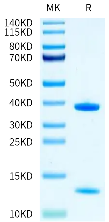 Human HLA-A*11:01&B2M&KRAS G12V (VVGAVGVGK) Monomer on Tris-Bis PAGE under reduced condition. The purity is greater than 95%.Recombinant Human HLA-A*11:01&B2M&KRAS G12V (VVGAVGVGK) Monomer Protein