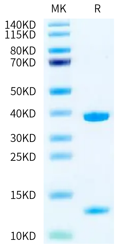 Biotinylated Human HLA-A*11:01&B2M&KRAS G12V (VVGAVGVGK) Monomer on Tris-Bis PAGE under reduced condition. The purity is greater than 95%.Biotinylated Human HLA-A*11:01&B2M&KRAS G12V (VVGAVGVGK) Monomer Protein