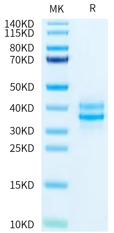 Cynomolgus/Rhesus macaque EpCAM on Tris-Bis PAGE under reduced condition. The purity is greater than 95%.Recombinant Cynomolgus/Rhesus macaque EpCAM/TROP1 Protein, Active