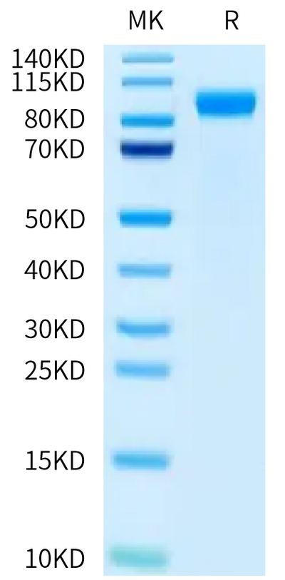 Mouse ACE2 on Tris-Bis PAGE under reduced condition. The purity is greater than 95%.Recombinant Mouse ACE2 Protein