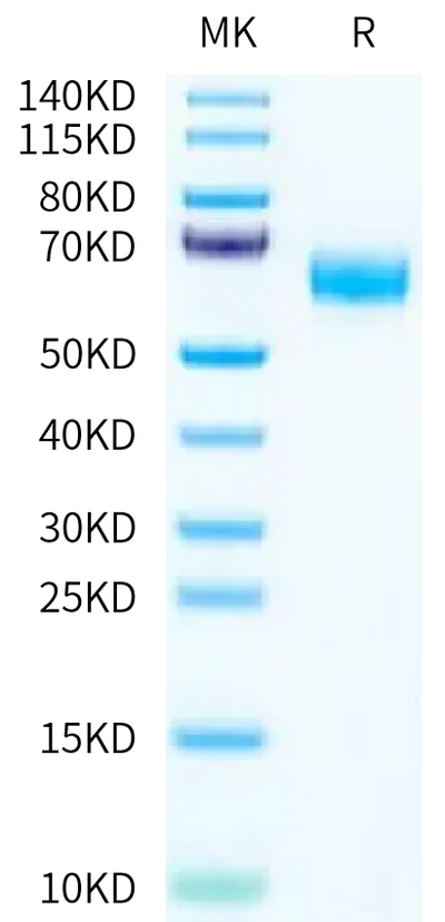 Mouse VNN1 on Tris-Bis PAGE under reduced condition. The purity is greater than 95%.Recombinant Mouse VNN1 Protein