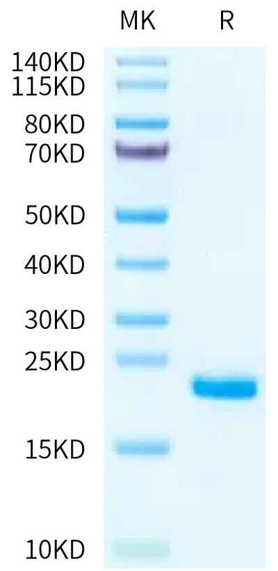 Human IL-1F10 on Tris-Bis PAGE under reduced condition. The purity is greater than 95%.Recombinant Human IL-1F10/IL-38-Protein, Active