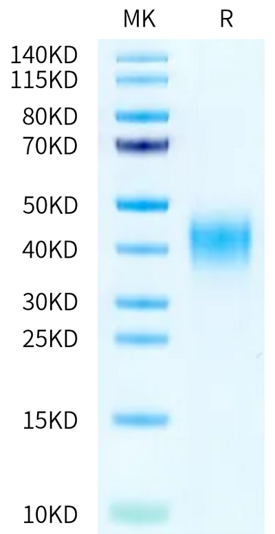 Human CD47 on Tris-Bis PAGE under reduced condition. The purity is greater than 95%.