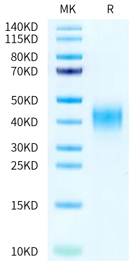 Human CD47 on Tris-Bis PAGE under reduced condition. The purity is greater than 95%.Recombinant Human CD47 Protein, Active