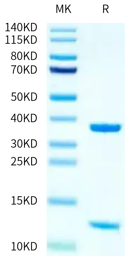 Human HLA-A*11:01&B2M&KRAS WT (VVVGAGGVGK) Monomer on Tris-Bis PAGE under reduced condition. The purity is greater than 95%.Recombinant Human HLA-A*11:01&B2M&KRAS WT (VVVGAGGVGK) Monomer Protein