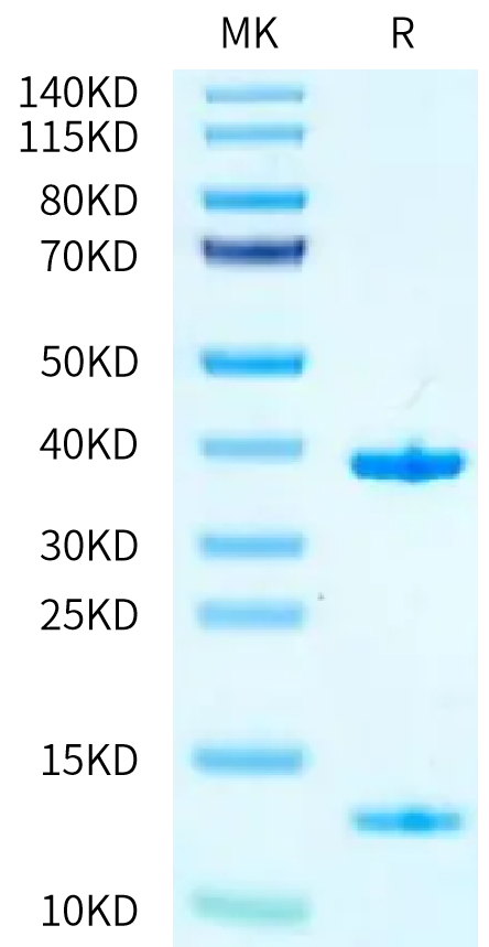 Biotinylated Human HLA-A*11:01&B2M&KRAS WT (VVVGAGGVGK) Monomer on Tris-Bis PAGE under reduced condition. The purity is greater than 95%.Biotinylated Human HLA-A*11:01&B2M&KRAS WT (VVVGAGGVGK) Monomer Protein