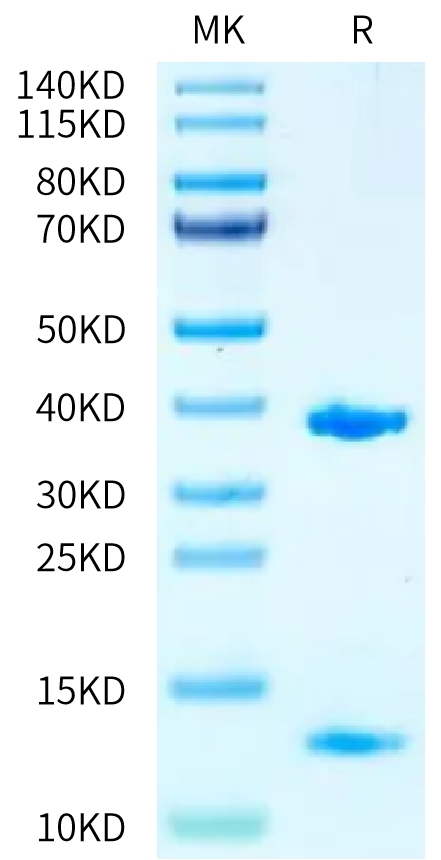 Biotinylated Human HLA-A*11:01&B2M&KRAS WT (VVGAGGVGK) Monomer on Tris-Bis PAGE under reduced condition. The purity is greater than 95%.Biotinylated Human HLA-A*11:01&B2M&KRAS WT (VVGAGGVGK) Monomer Protein