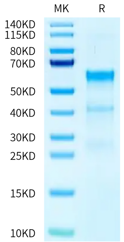Human TENM2 on Tris-Bis PAGE under reduced condition. The purity is greater than 90%.Recombinant Human TENM2 Protein