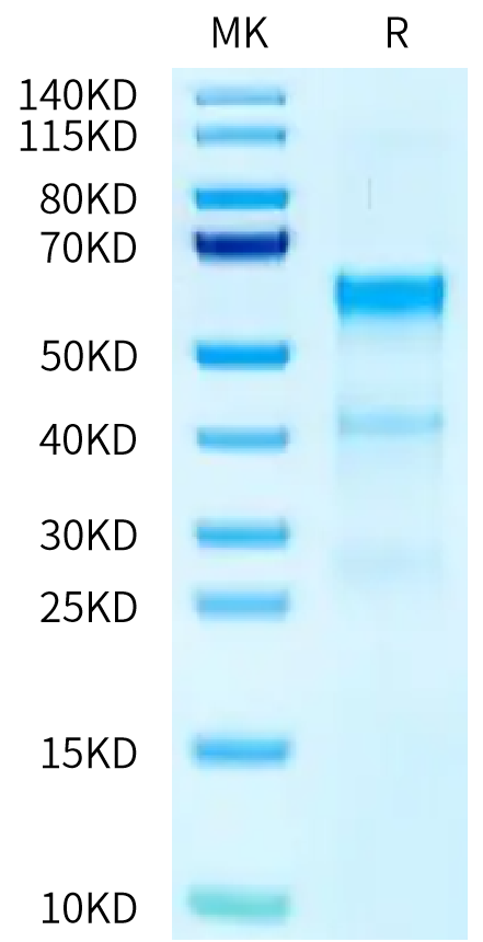 Human TENM2 on Tris-Bis PAGE under reduced condition. The purity is greater than 90%.Recombinant Human TENM2 Protein
