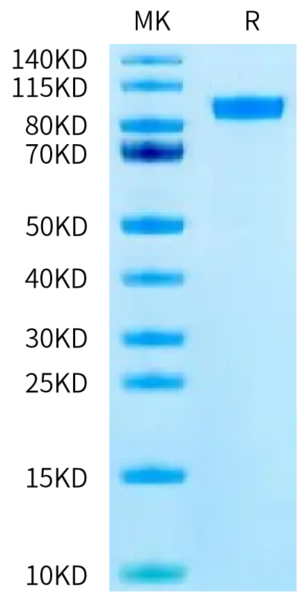 Mouse Her2 on Tris-Bis PAGE under reduced condition. The purity is greater than 95%.Recombinant Mouse Her2/ErbB2 Protein, Active