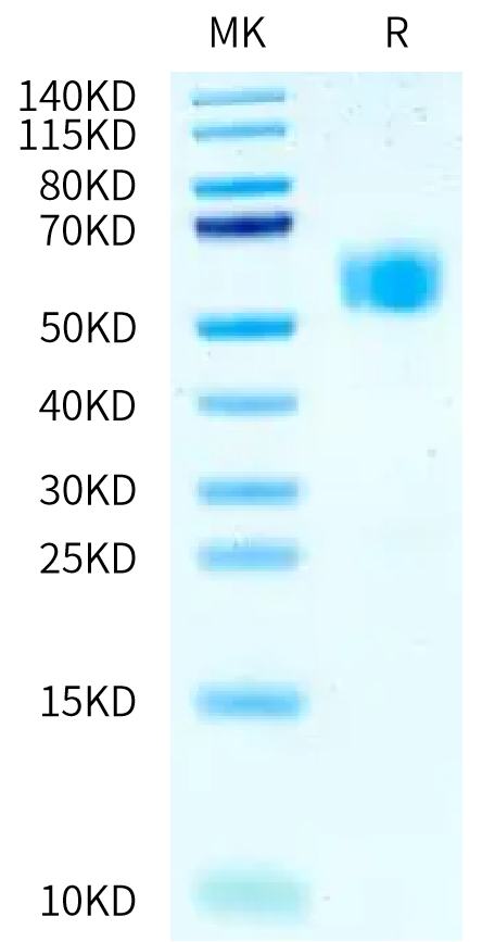 Human IL-1R1 on Tris-Bis PAGE under reduced condition. The purity is greater than 95%.Recombinant Human IL-1R1 Protein, Active
