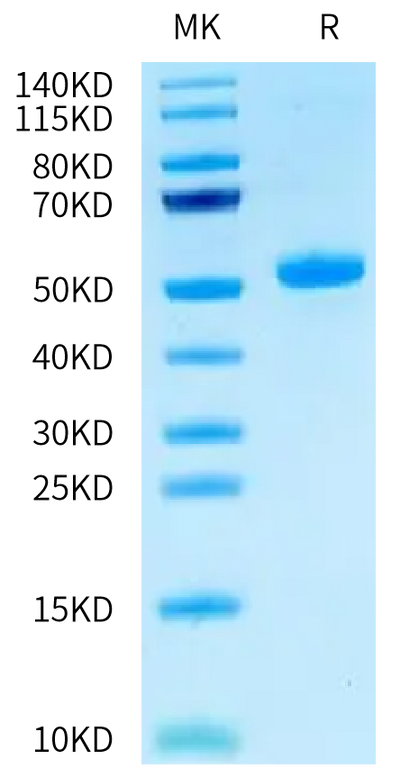 Human CEACAM-3 on Tris-Bis PAGE under reduced condition. The purity is greater than 95%.Recombinant Human CEACAM-3 Protein, Active