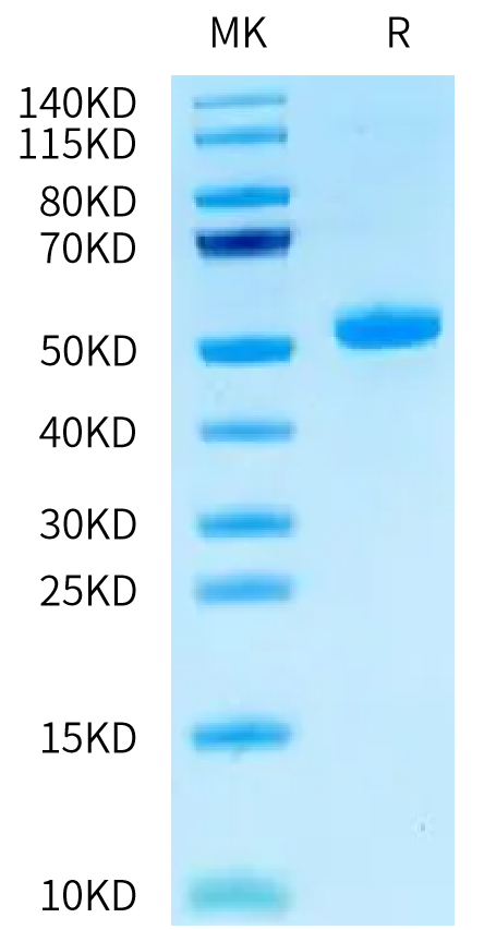 Human CEACAM-3 on Tris-Bis PAGE under reduced condition. The purity is greater than 95%.Recombinant Human CEACAM-3 Protein, Active