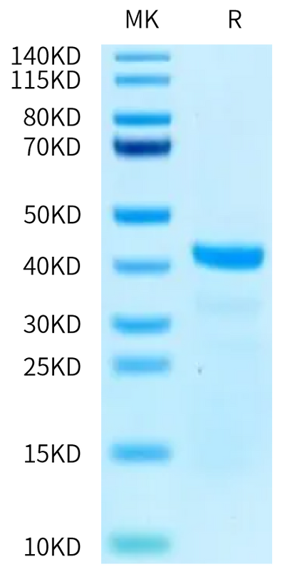 Human ERK2 on Tris-Bis PAGE under reduced condition. The purity is greater than 95%.Recombinant Human ERK2 Protein
