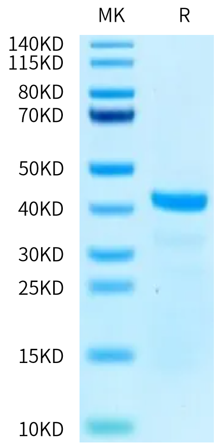 Human ERK2 on Tris-Bis PAGE under reduced condition. The purity is greater than 95%.Recombinant Human ERK2 Protein