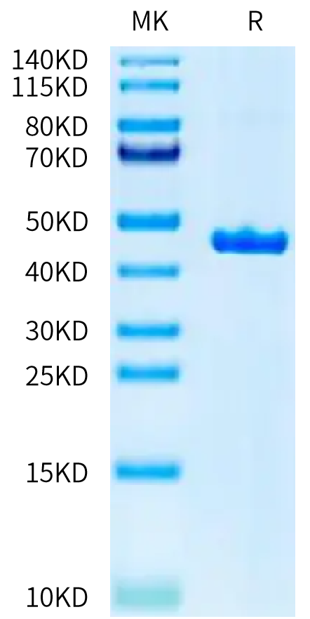 Human CKMT1A on Tris-Bis PAGE under reduced condition. The purity is greater than 95%.Recombinant Human CKMT1A Protein