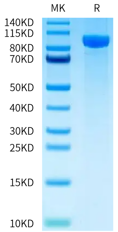 FITC-Labeled Human Her3 on Tris-Bis PAGE under reduced condition. The purity is greater than 95%.Recombinant FITC-Labeled Human Her3/ErbB3 Protein, Active