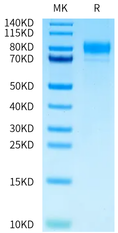 Human M-CSF R on Tris-Bis PAGE under reduced condition. The purity is greater than 95%.Recombinant Human M-CSF R/CSF1R/CD115 Protein, Active